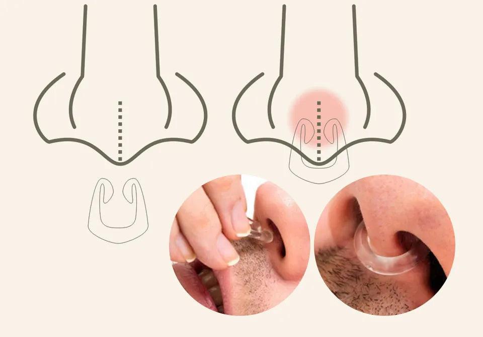 Clips Antirronquidos para Dejar de Roncar - Tienda Kiosko